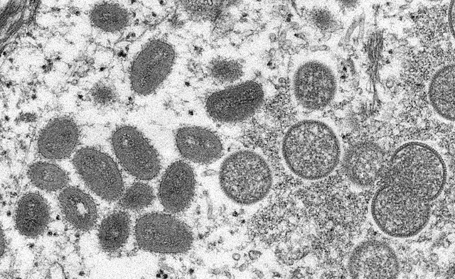 This electron microscopic (EM) image depicted a monkeypox virion.