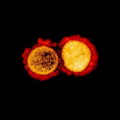 Transmission electron micrograph of SARS-CoV-2 virus particles, isolated from a patient. Image captured and color-enhanced at the NIAID Integrated Research Facility (IRF) in Fort Detrick, Maryland. Credit: NIAID.