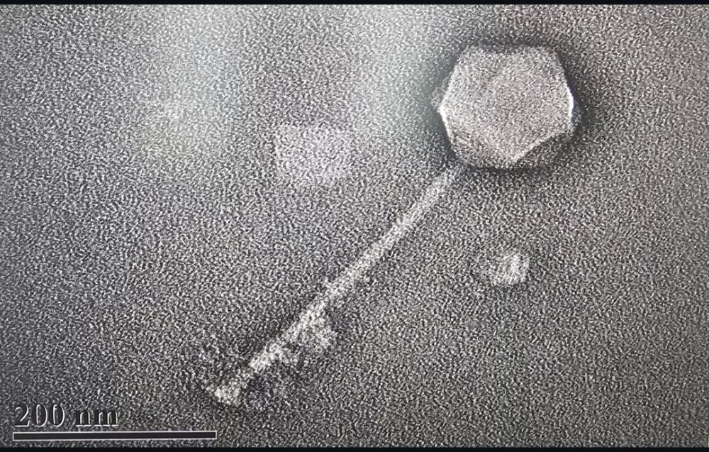  TEM of phage G